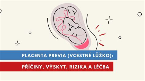Predná placenta a pohyby plodu: Čo očakávať?